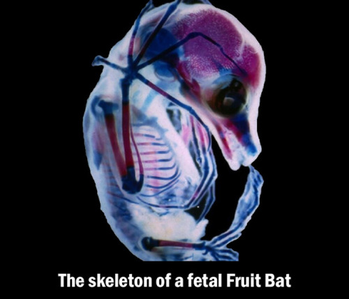 asapscience:This fruit bat is in its third-trimester. [NikonSmallWorld]