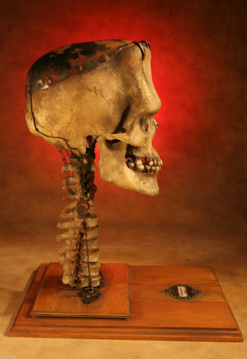 XXX horroroftruant:  The Skull of Frankenstein’s photo