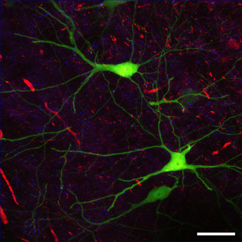 Mouse brain, confocal microscopy | ZEISS Microscopy