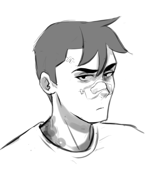 poor-sickies:I like to think Shiro went through a really bad depression after his car accident on my