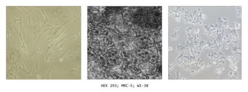 Microscopic photos of HEK 293; MRC-5; WI-38