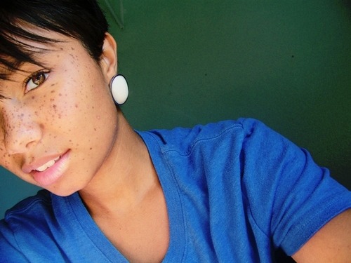 lasttrainleaving:  Freckle game on point 