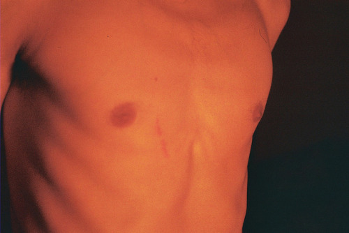 untrustyou:  Simon Marsham