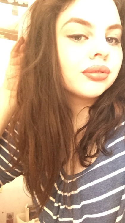 My lips look like they&rsquo;ve been taken of a brats doll so the injections went well