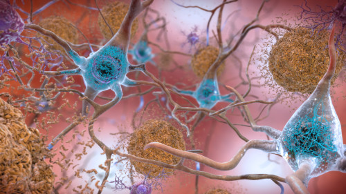 Tackling Tau to Treat Alzheimer’sUC San Diego researchers and collaborators in Italy identified an i