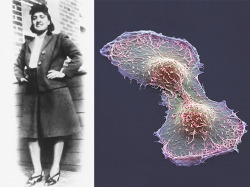 bpod-mrc:  Immortality in Death    Henrietta Lacks (pictured) died of cervical cancer in 1951. But before her death, a biopsy sample from her cervix was used to successfully grow the first human cell line – HeLa cells. HeLa cells are widely used in