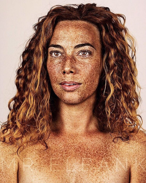 asylum-art-2:Freckled  Photographer Brock Elbank‘s ongoing project #Freckles has gathered together a