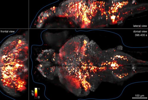 fennetic: Whole-brain functional imaging at cellular resolution using light-sheet microscopy (o