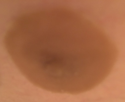 ftmproductreviews:GenderMender ftm prosthetic nipples!Hey guys today I’m going to tell you about a c
