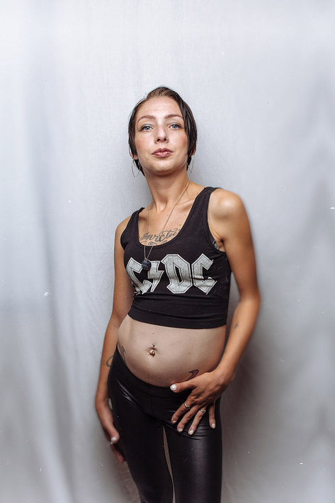 talapishka:    A Photographer Started A Photo Project To Show That Women With Cystic