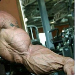 drwannabe:  Lee Priest’s swollen arm