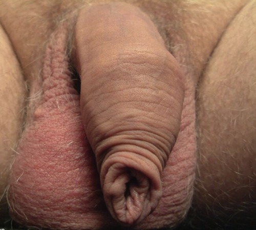 foreskin-xxxtra: A collage of extra puckers