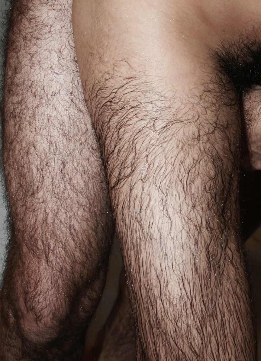 Beardburnme