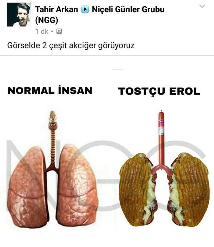 Görselde 2 çeşit akciğer...