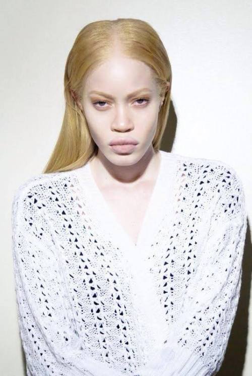 Beautiful black Albino