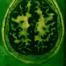 Calliope Stim Bord