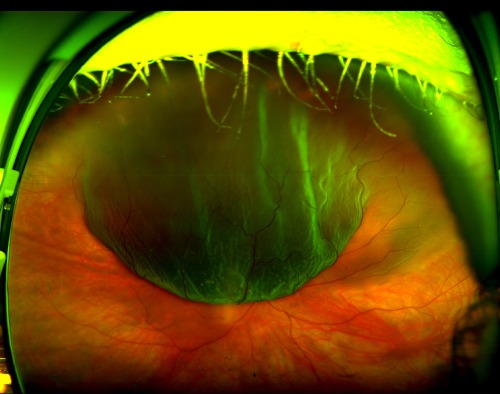 pinpoint flashes of light in vision pinpoint flashes of light in vision