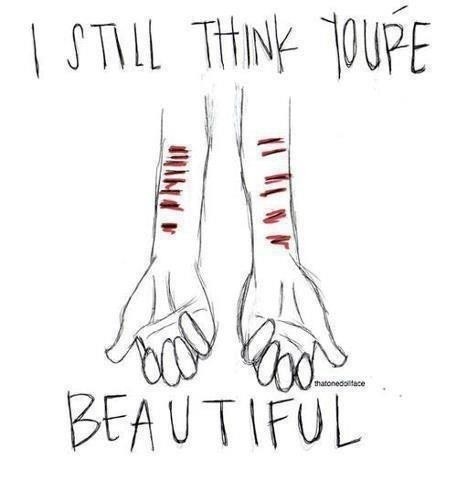 i kissed the scars on her skin, i still think youre beautiful, and i dont ver wanna