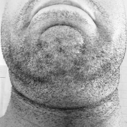 contemporaryillusions:  Seeing the skin of your neck after having a beard for 7 months like…