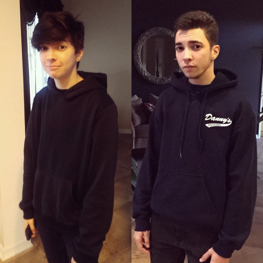 ashtondrew:  Right before getting my first shot of testosterone / VS / 1 year on