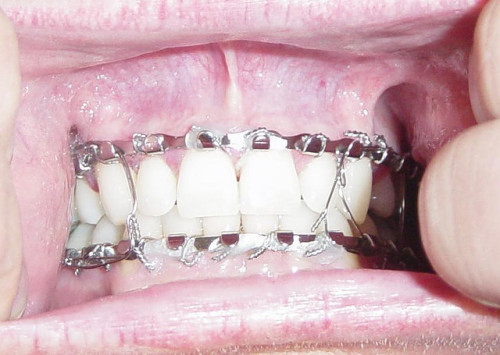 Porn photo biverbal:  mouth by the_robio on Flickr.