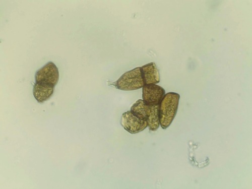 Rust fungus (Puccinia sp.) on chives (Allium schoenoprasum).