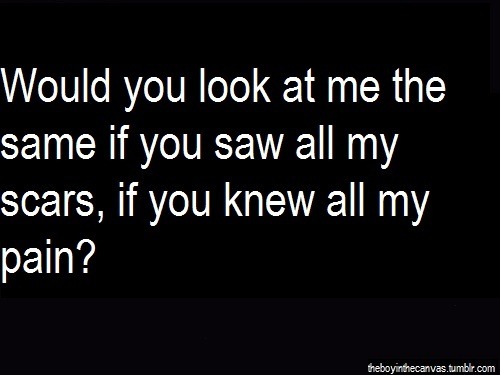 beingaselfharmer:  I doubt that..