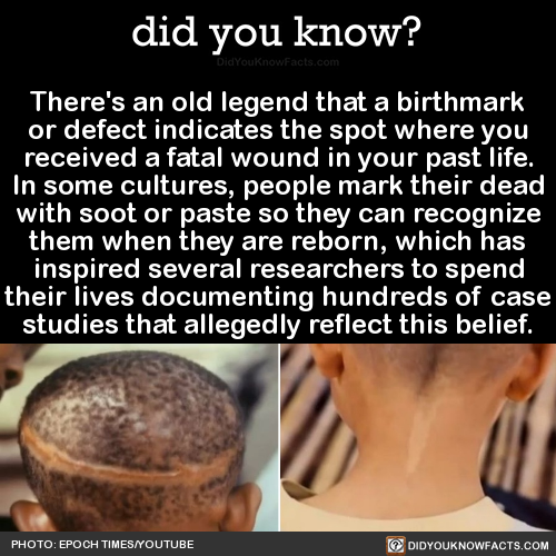 sapphic-matriarchy:did-you-kno:There’s an old legend that a birthmarkor defect indicates the spot wh