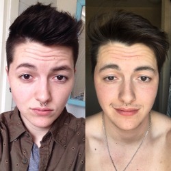 seethestarsablaze:  fremethescamu:  seethestarsablaze:  Day 1 vs day 366. I’m officially 1 year on T, I can’t even believe it!  amazingly you somehow managed to look worse  Feel free to block this page y'all 👆🏼 it’s pretty damn adorable how