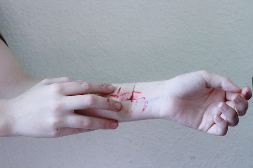 Pain of a suicid3