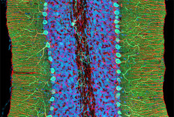 medicalschool:  Fluorescence image of a rat cerebellum stained to reveal the distribution of inositol triphosphate receptors in Purkinje neurons (green), GFAP in glial cells (red), and DNA throughout the cells (cyan). The image was acquired by multiphoton