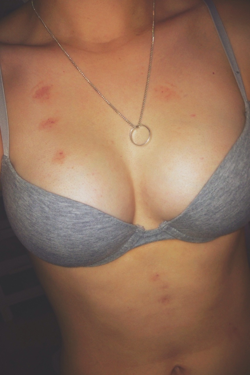 officialpussypatrol:  for-the-homies:  oops…  damn ಠ_ಠ 
