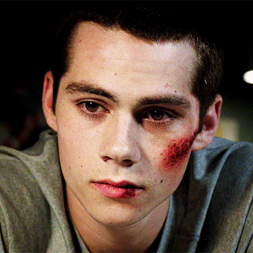 Teen Wolf 2x12 But It Goes A Little Different.