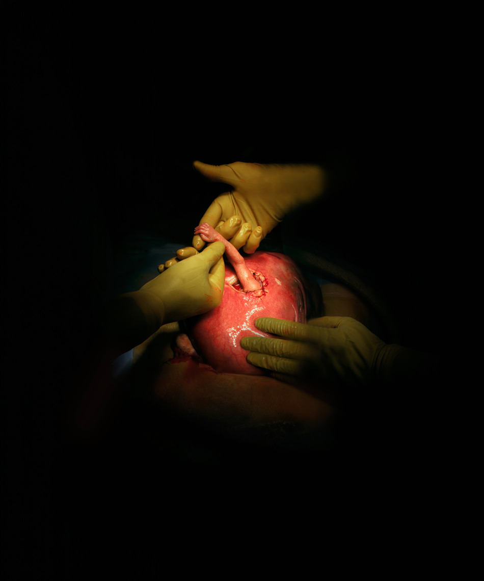 ether927:  Incredible photos from the operating room taken by Max Aguilera-Hellweg