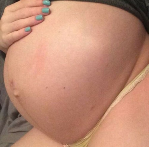 tidytum: Submission by: https://www.instagram.com/inflaterteen/  Submit your sexy pregnancy pictures to Tidytum and we’ll promote your social media accounts. Or if you want you can have your face edited out or remain anonymous.  We’re working on building