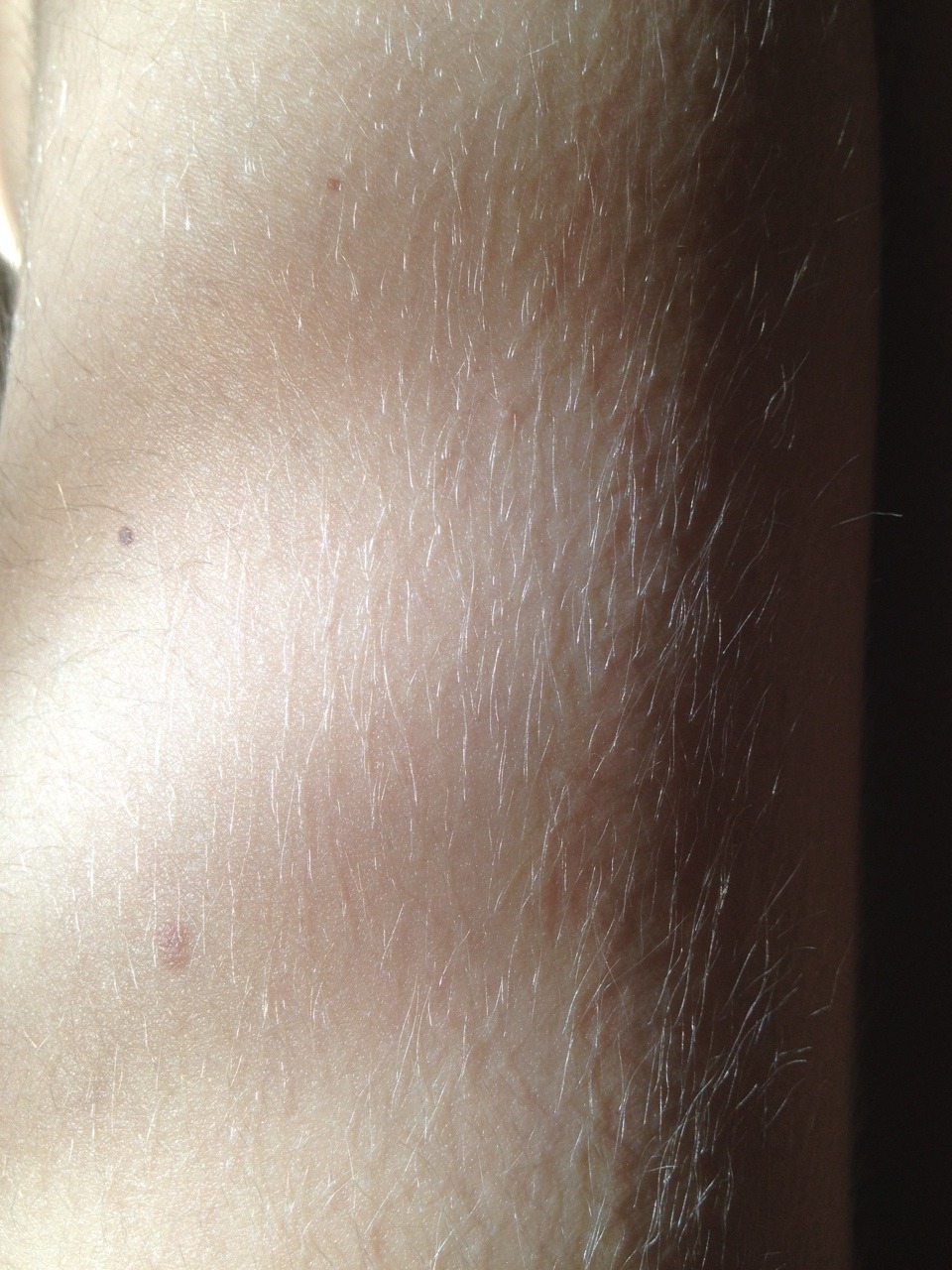 je-vois-la-lune:Body hair appreciation post bc it’s actually real cute to me and