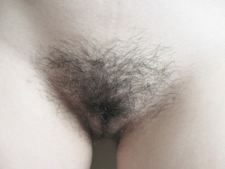 Hairy Women