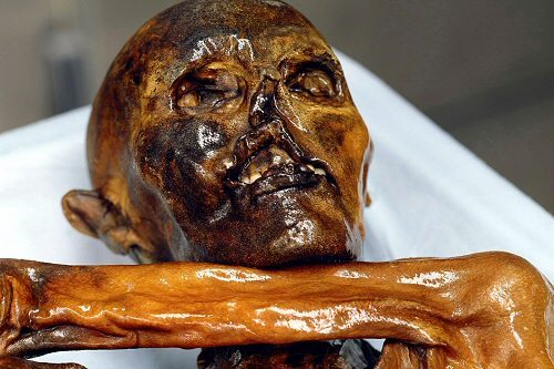 theolduvaigorge:Neolithic Iceman Ötzi Had Bad Teeth: Periodontitis, Tooth Decay, Accident-Related De