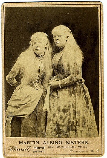 carnytrash:  resonanceinthehalls:  Vintage Photography of Circus ‘freaks’ and