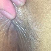euroasiansquirter:  Close up of my asshole. Any asshole lickers out there that’ll