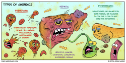 littlestudynook:  Jaundice is a yellow discoloration of the skin and mucous membranes caused by an excess accumulation of bilirubin in the blood. Bilirubin (a tetrapyrrole) is a product of red blood cell (RBC) breakdown. Jaundice becomes visible when