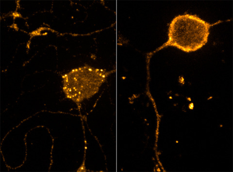 neurosciencestuff:  (Image caption: After treatment with the DAMGO, an endogenous