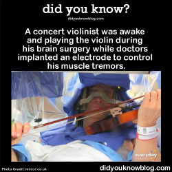 did-you-kno:  A concert violinist was awake