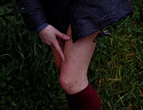 “&hellip;Of course we will hurt each other. But this is the very condition of existence. T