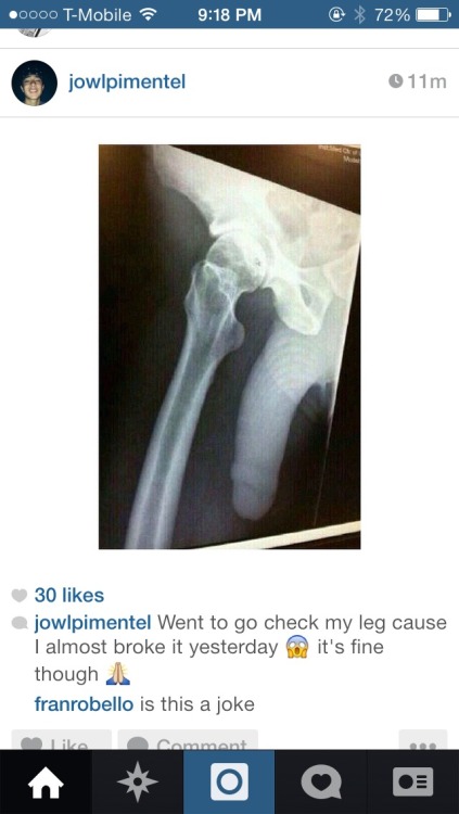 frantbh:so glad his leg isnt broken