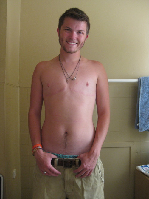 cameoamalthea:  iknowwhoholdstomorrow:  azryal00:  leaveyourdoubt:  askytheycannotbury:  Oh what a difference a year makes. one year post-op. one year three months on T. original post: this is what a man looks like.  the smile is the real difference