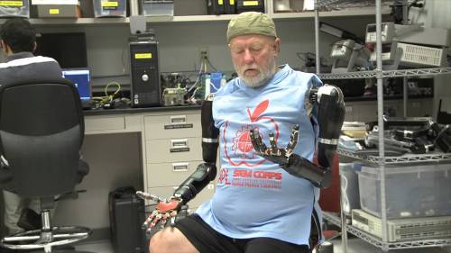 »TECHTUESDAY | Les Baugh - Controls Two Robotic Limbs With His MindLes Baugh lost both his arms fort