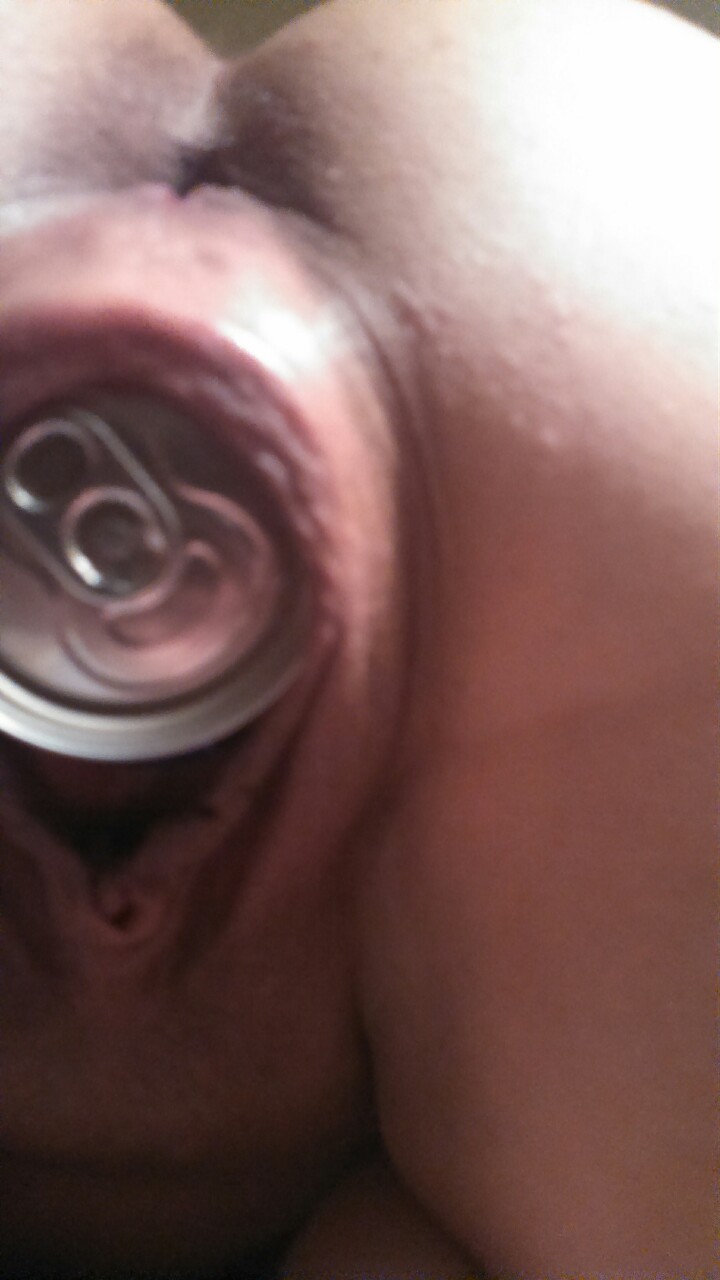 christineyates181:  Can’t wait till it just falls out.  Christine Yates wants to