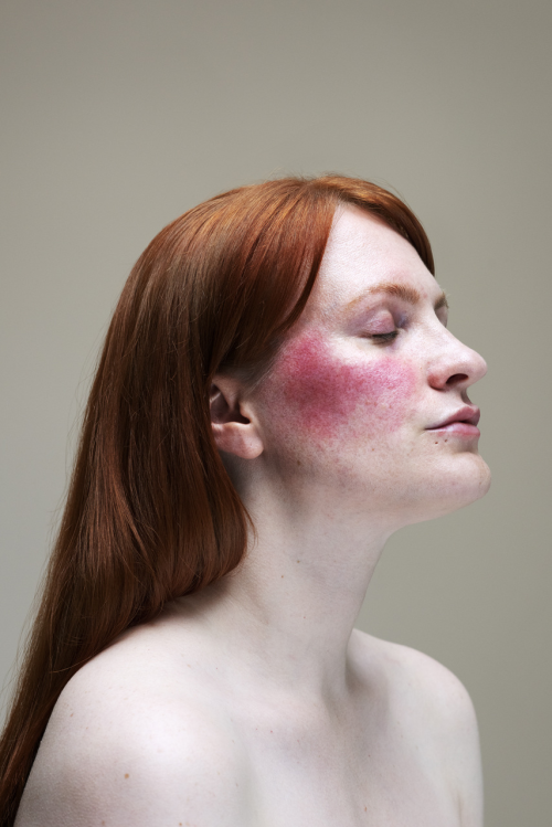 lopunny:Epidermis by Sophie Harris Taylor In the vein of classic ‘beauty’ photography, Epidermis hig