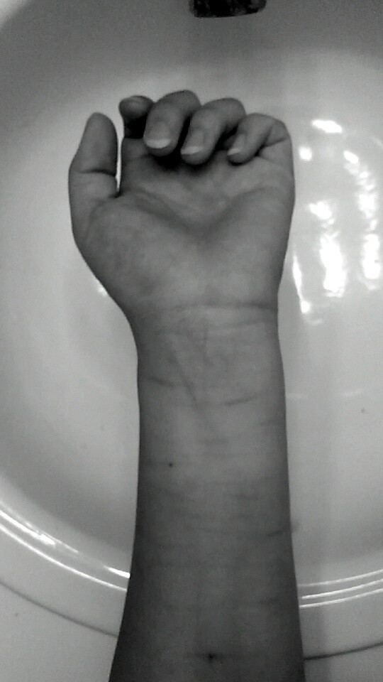 We all have wounds.-